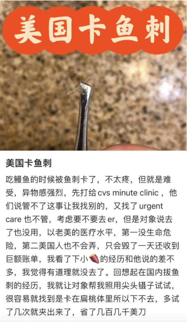 中国留学生鱼刺卡喉：惊动6名专家！收帐单傻眼