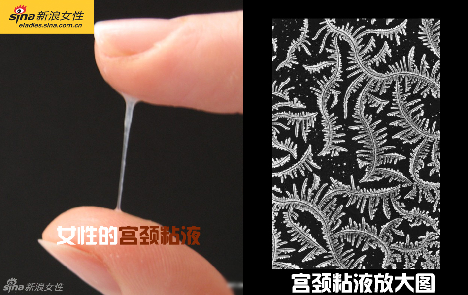 难得一见：从接吻到生子 震撼高清图解造人的全过程