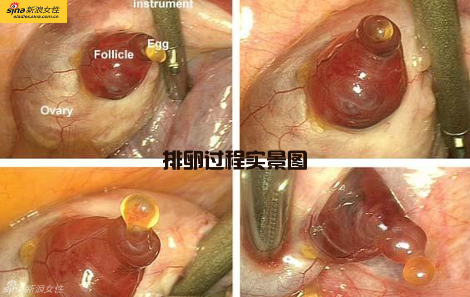 难得一见：从接吻到生子 震撼高清图解造人的全过程