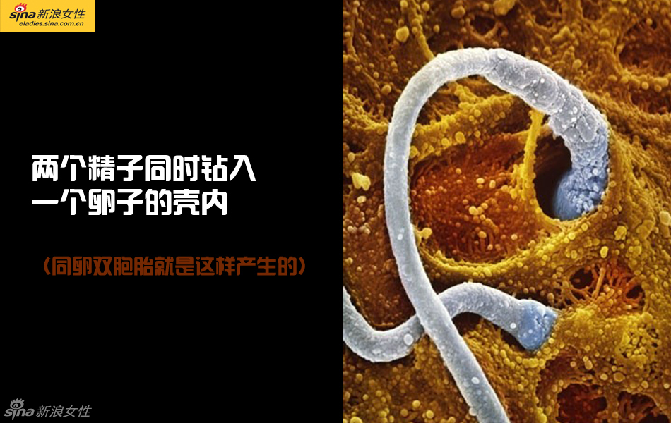 难得一见：从接吻到生子 震撼高清图解造人的全过程