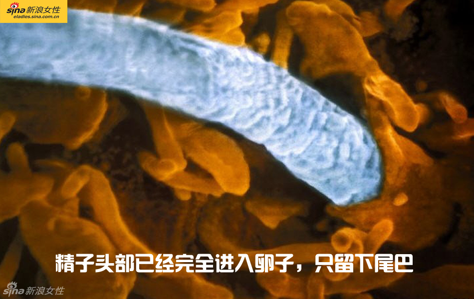 难得一见：从接吻到生子 震撼高清图解造人的全过程