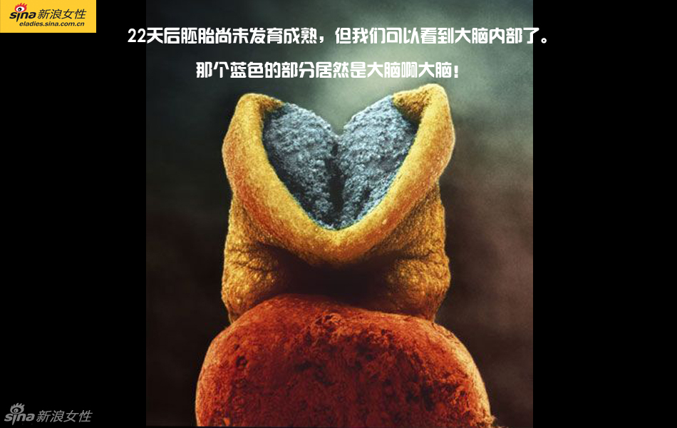 难得一见：从接吻到生子 震撼高清图解造人的全过程